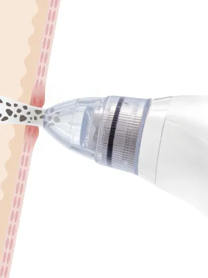 Elektrický obličejový čistič na černé tečky Pore·Off InnovaGoods